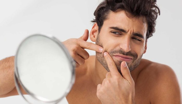 A acne pode aumentar o risco de depressão